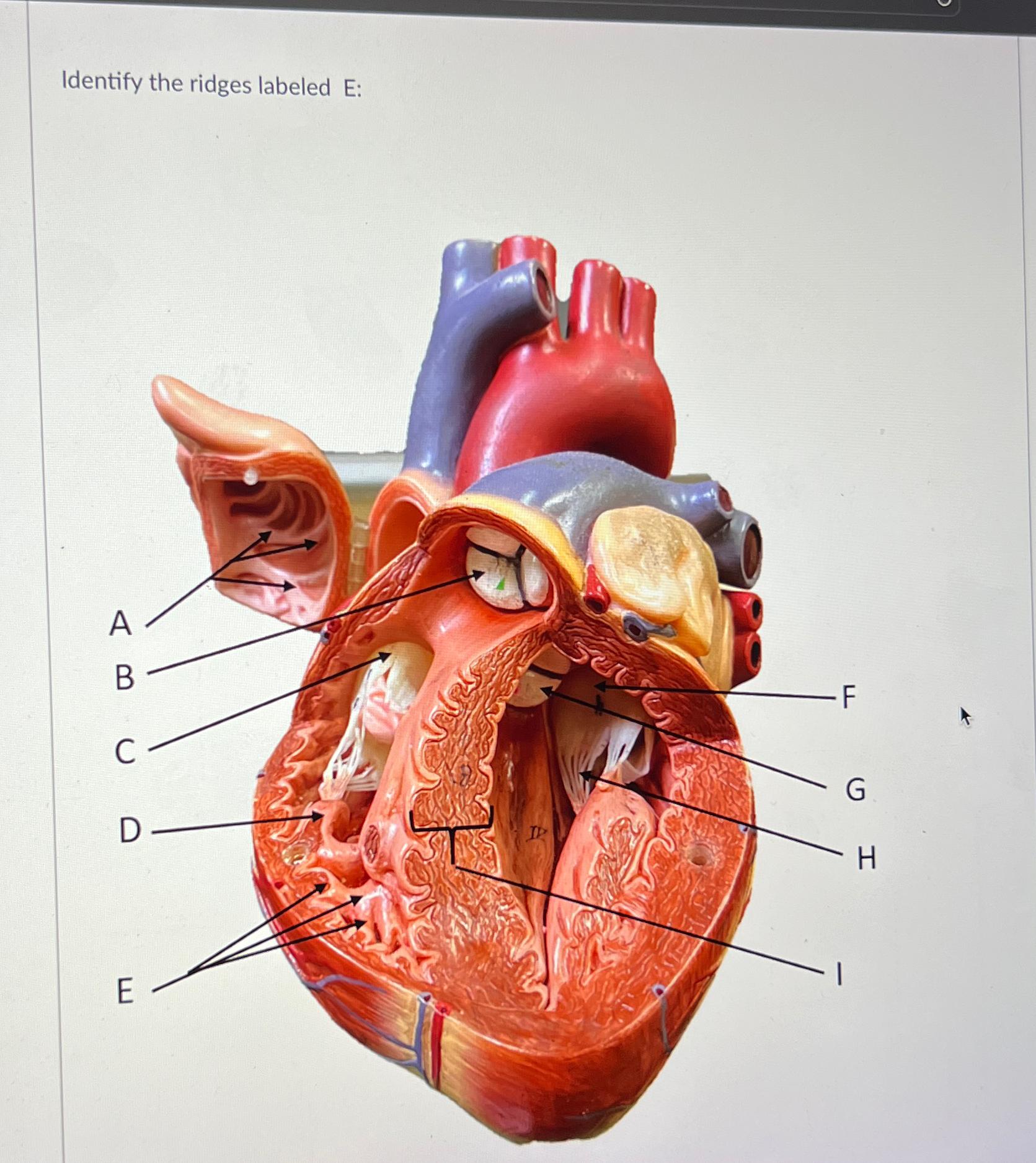 Solved Identify the ridges labeled E ﻿: | Chegg.com