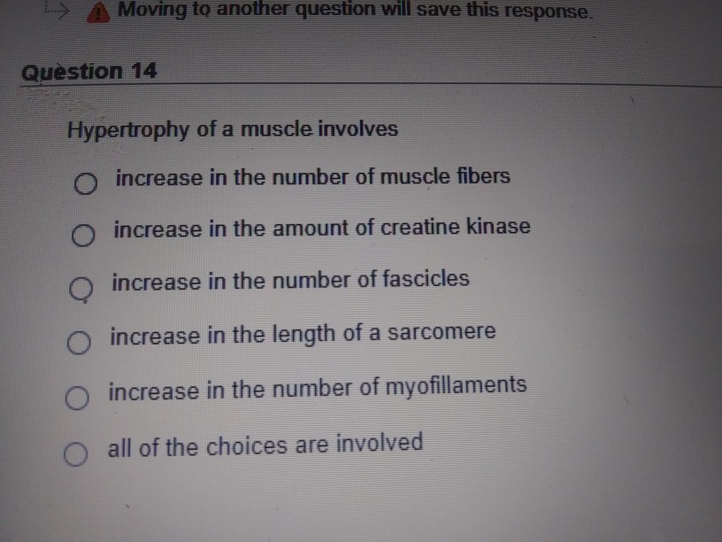 Solved Question 9 Which Of The Following Statements | Chegg.com Solved Question 9 Which Of The Following Statements | Chegg.com