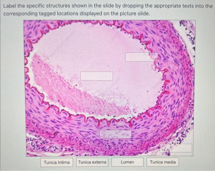 Solved Match the appropriate text to the corresponding | Chegg.com