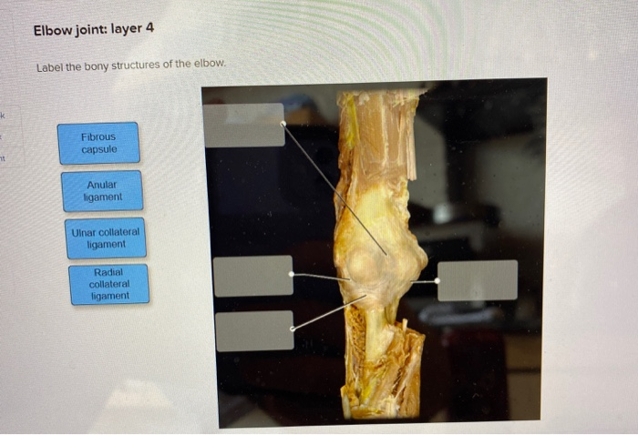 Solved Elbow joint: layer 4 Label the bony structures of the | Chegg.com