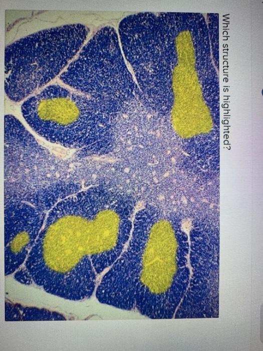 Which Structure Is Highlighted Cortex Of Thymus