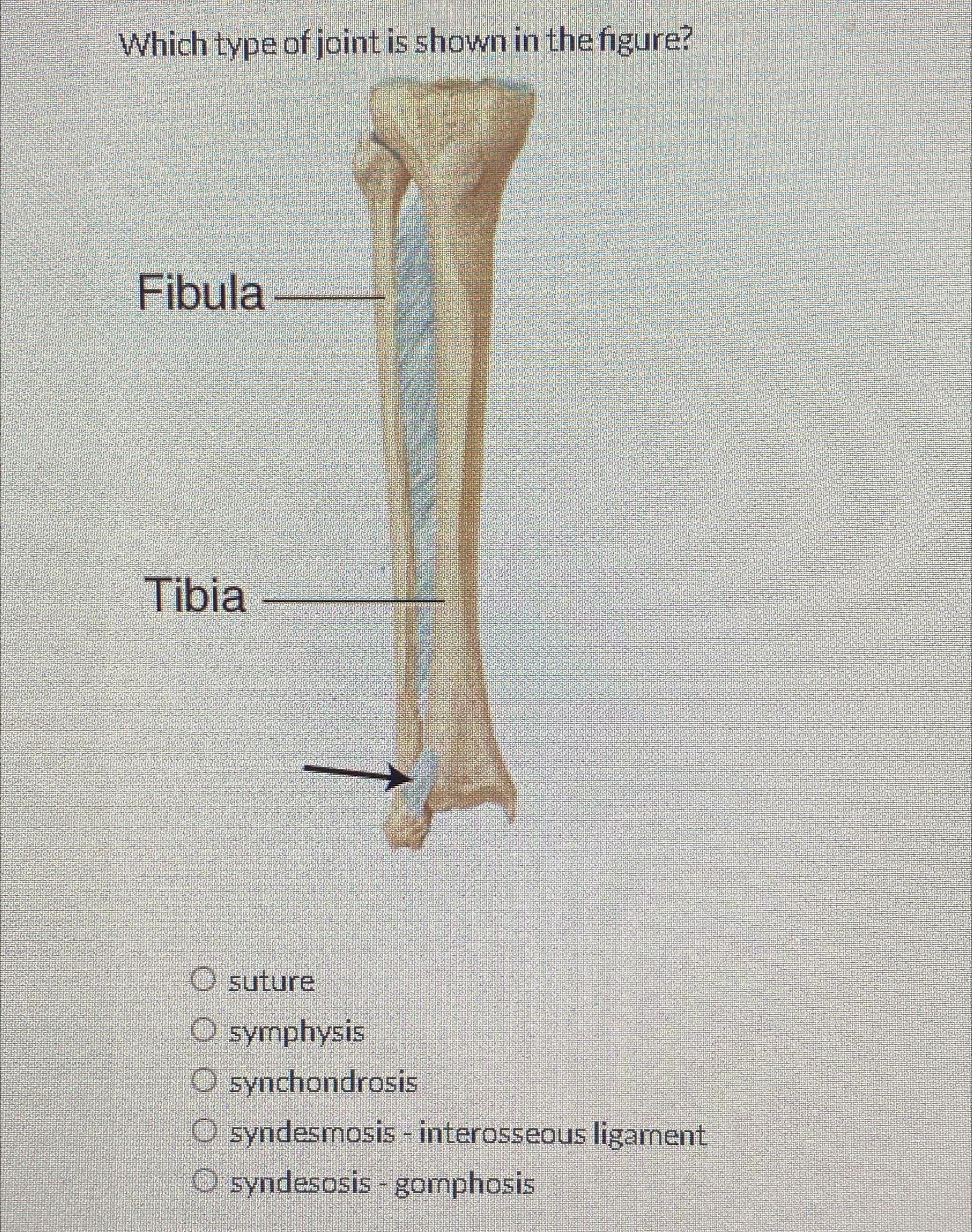 Solved Which type of joint is shown in the | Chegg.com