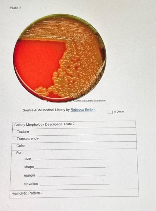 Solved Source ASM Medical Library by Rebecca Burton =2 mm | Chegg.com