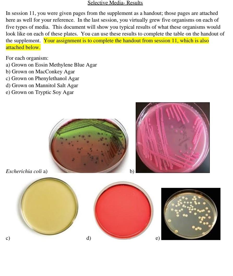 MacConkey Agar: Composition, Principle, Uses, And Procedure, 57% OFF