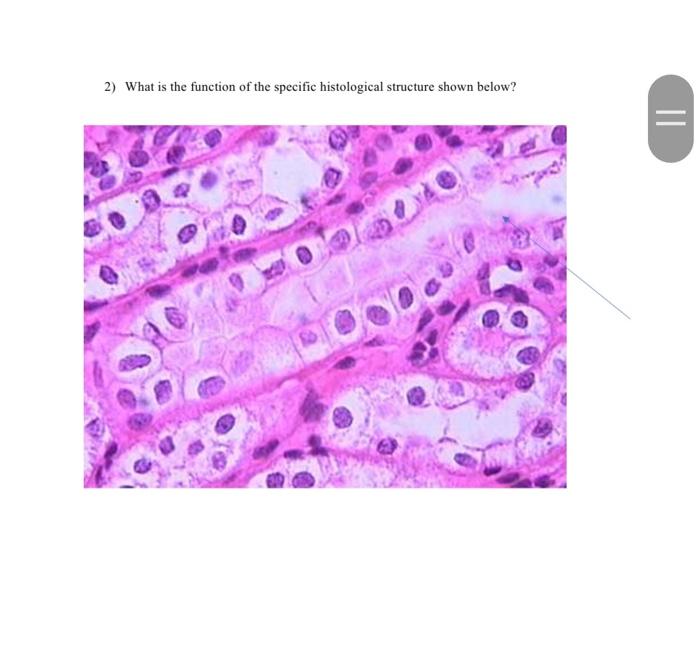 Solved 1) Identify the specific tissue below and justify | Chegg.com