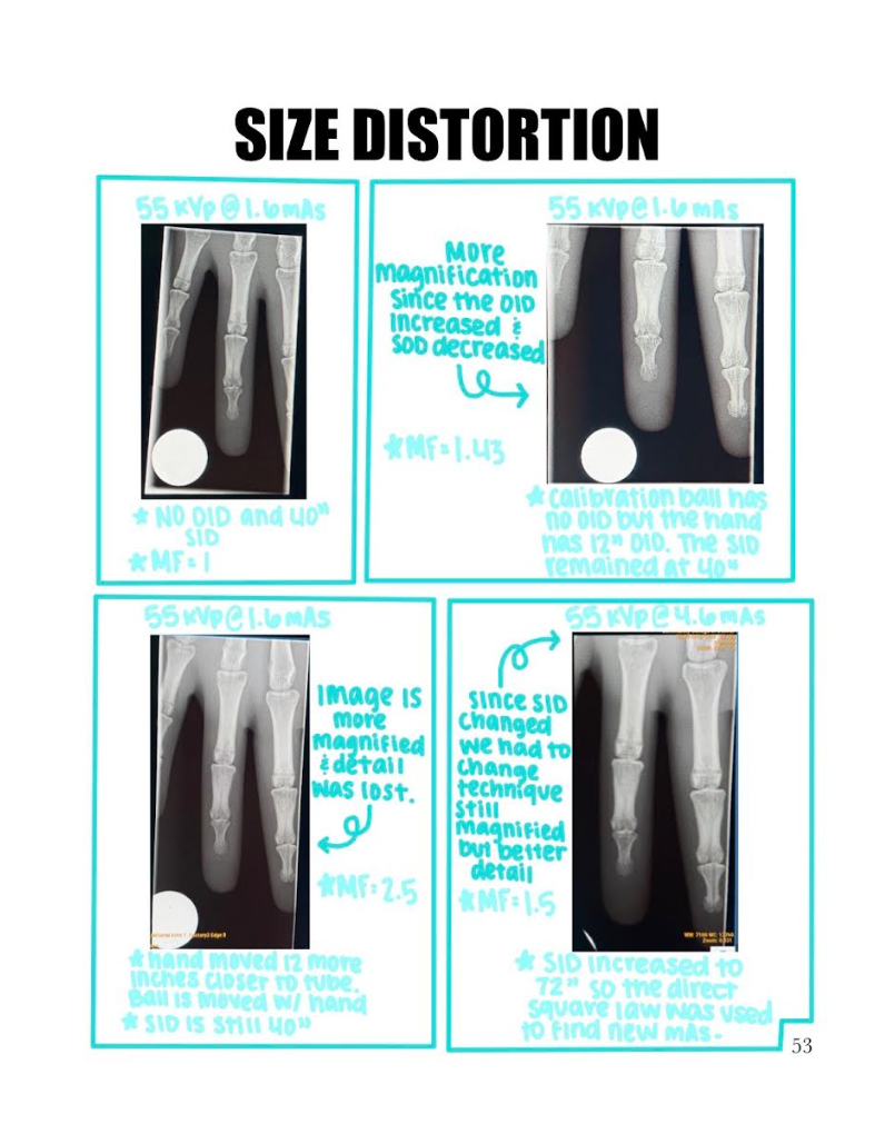 Size Distortion Radiograph Solved Notebook 13 – Size Distortion Describe | Chegg.com