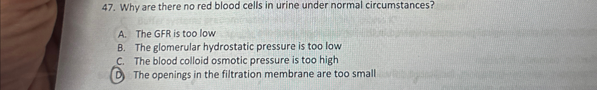 Solved Why are there no red blood cells in urine under | Chegg.com