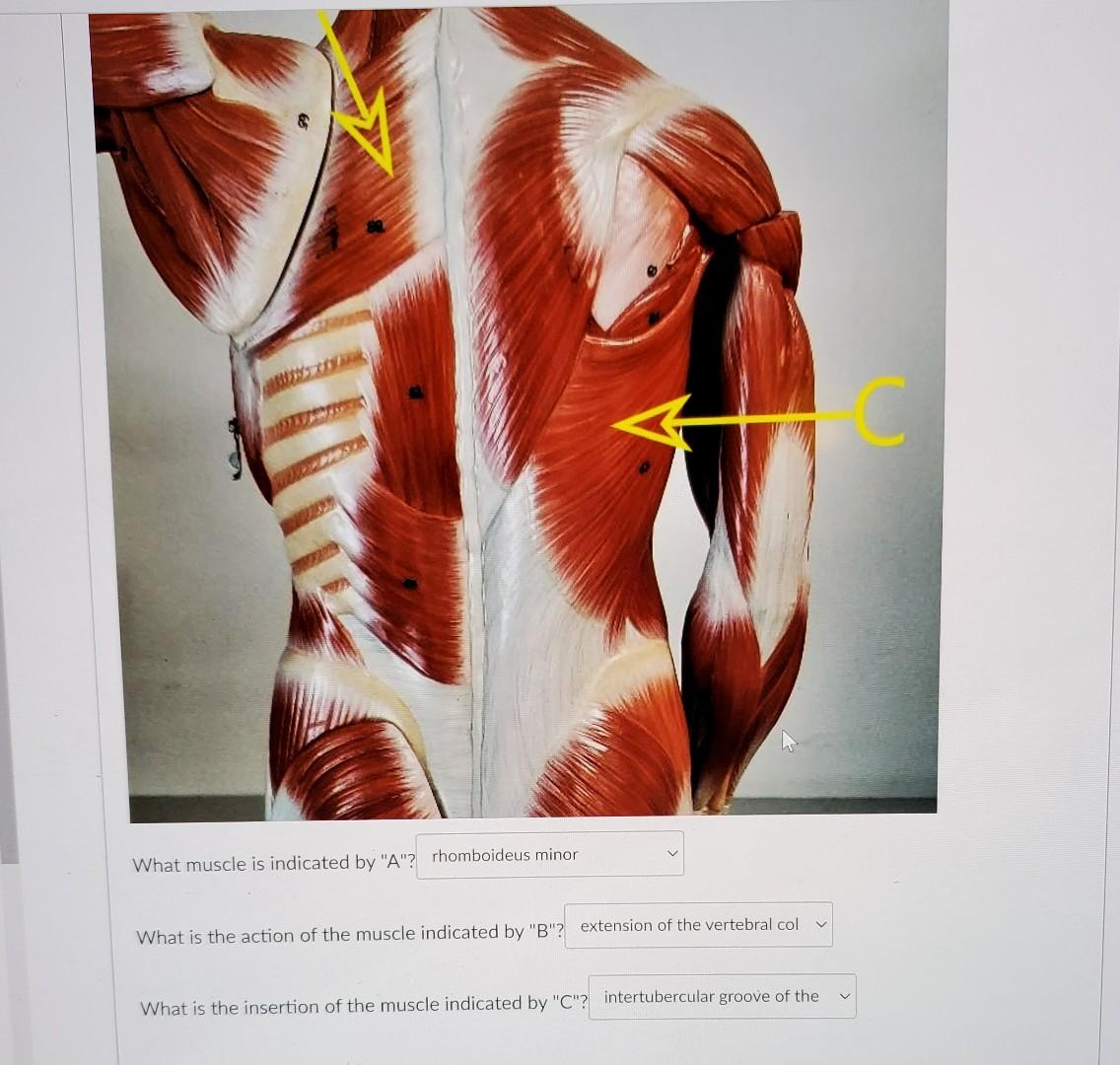 pin-on-muscle-stretches-for-trigger-points