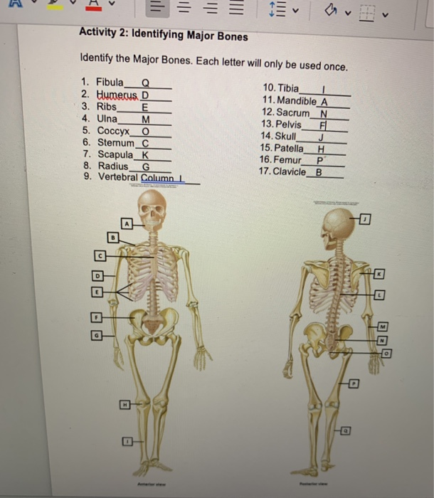 Solved Activity 2: Identifying Major Bones Identify the | Chegg.com