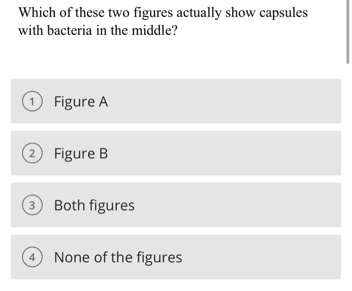 Solved A B ∞Identify this stain. Endospore capsule Gram | Chegg.com