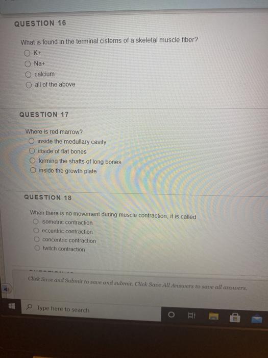 Solved QUESTION 16 What is found in the terminal cisterns of | Chegg.com