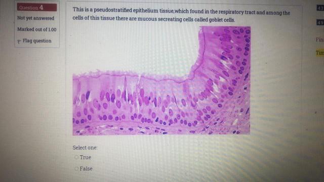 Solved Question 4 This is a pseudostratified epithelium | Chegg.com