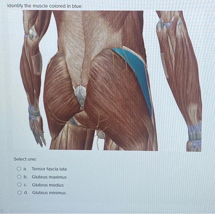 Identify the muscle colored in blue: Select one: a. | Chegg.com