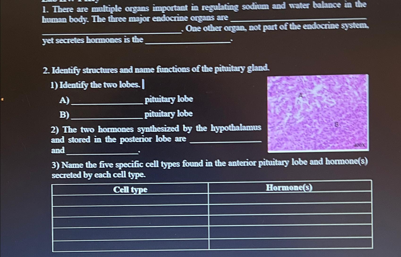 What Hormone Helps Maintain Salt And Water Balance In The Body Fluids