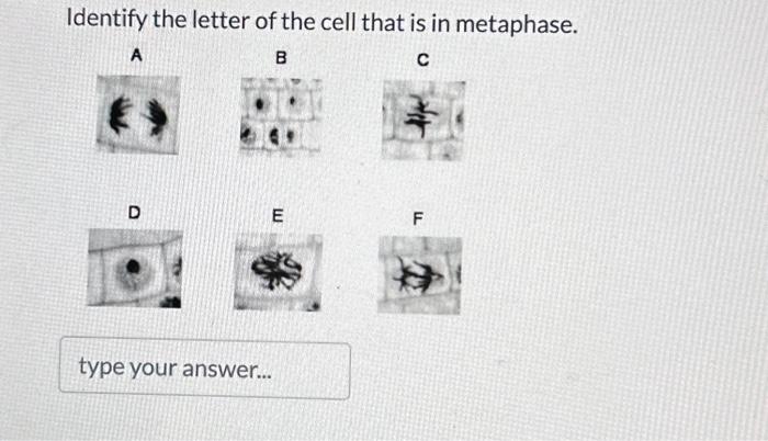Solved Identify the letter of the cell that is in metaphase. | Chegg.com