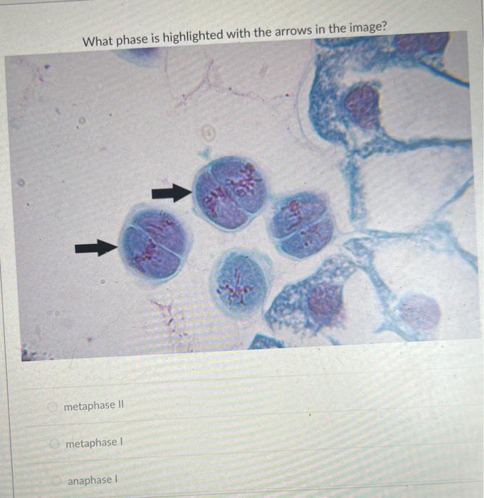 Solved What phase is highlighted in the image? interphase | Chegg.com