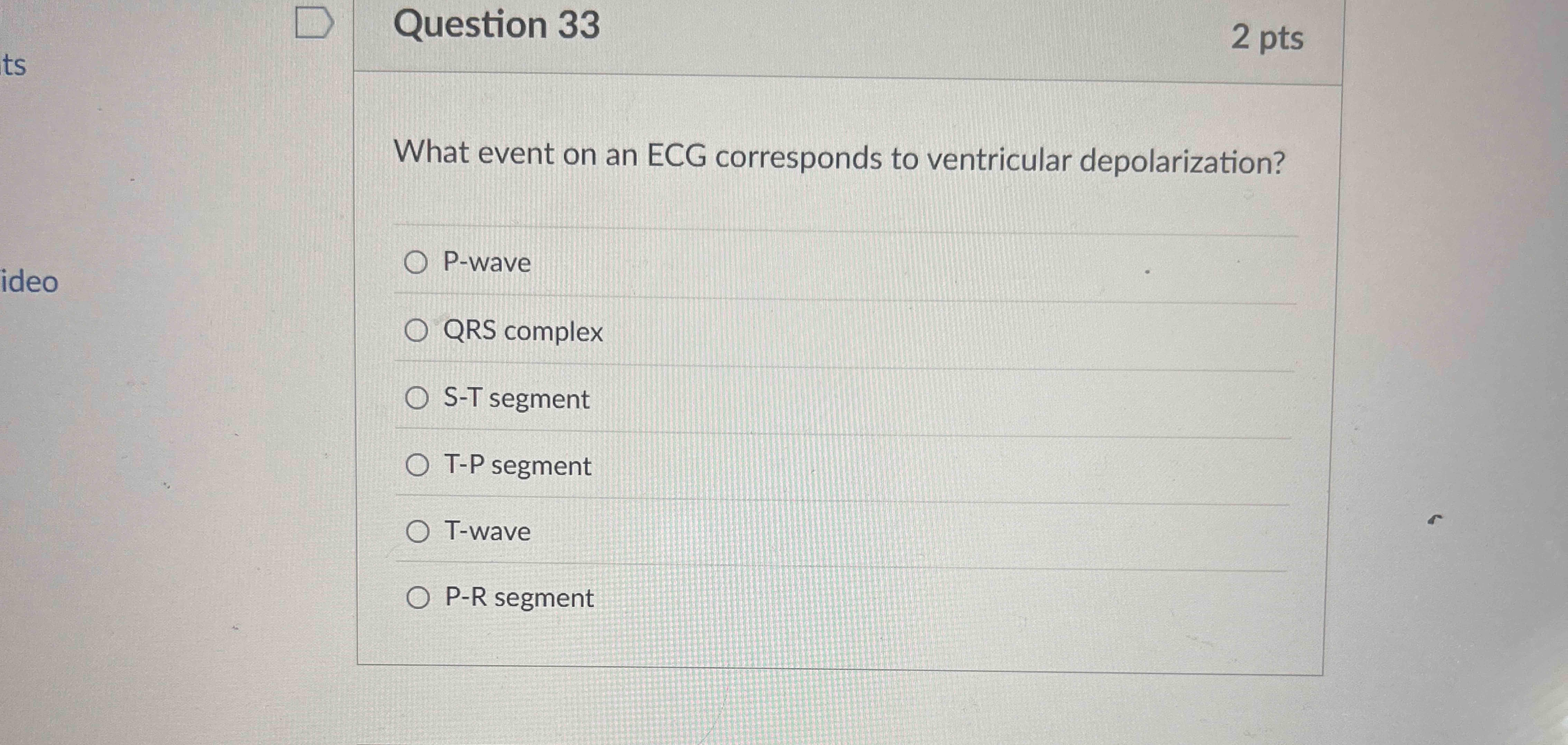 Solved Question 33What event on an ECG corresponds to | Chegg.com