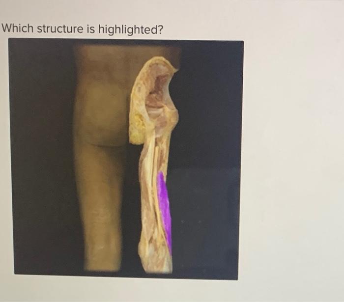 Which structure is hiahliahted?