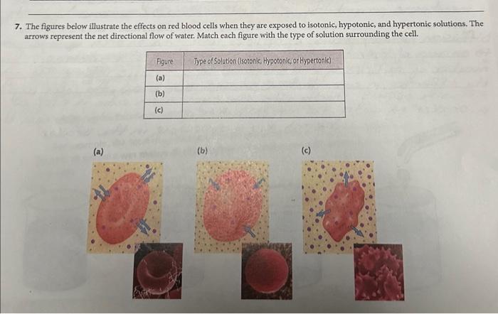 7. The figures below illustrate the effects on red blood cells when they are exposed to isotonic, hypotonic, and hypertonic s