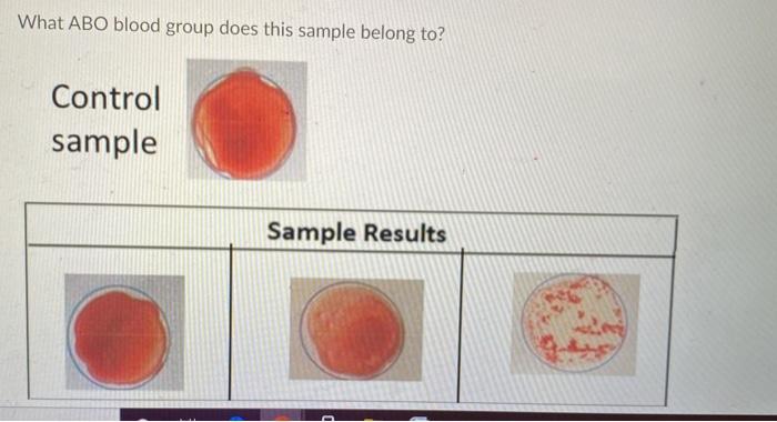 Solved What ABO blood group does this sample belong to? | Chegg.com