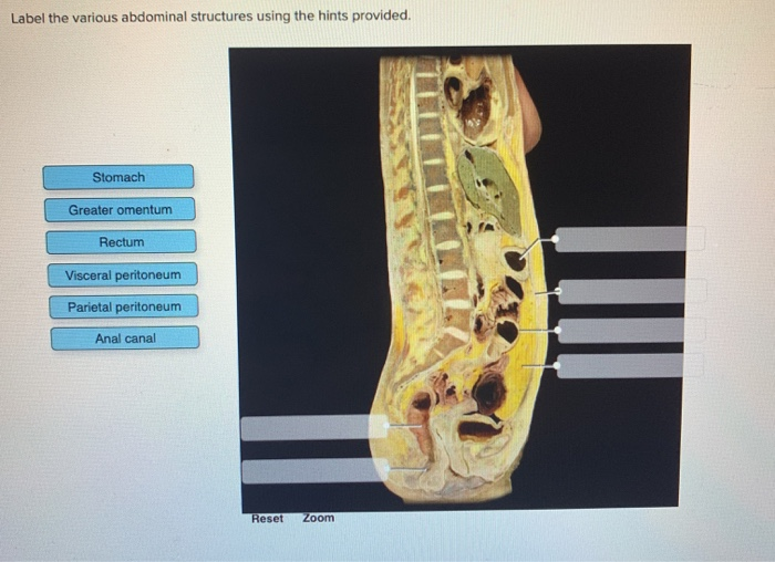 Solved Label the various abdominal structures using the