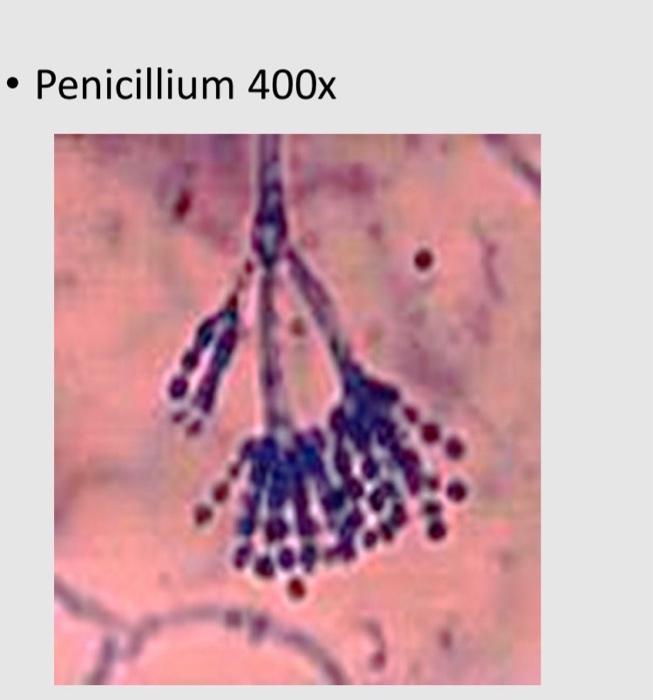 penicillium under microscope 400x