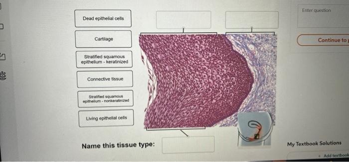 Dead epithelial cells
Cartilage
Stratified squamous
epithelium-keratinized
Connective tissue
Stratified squamous
epithelium-n