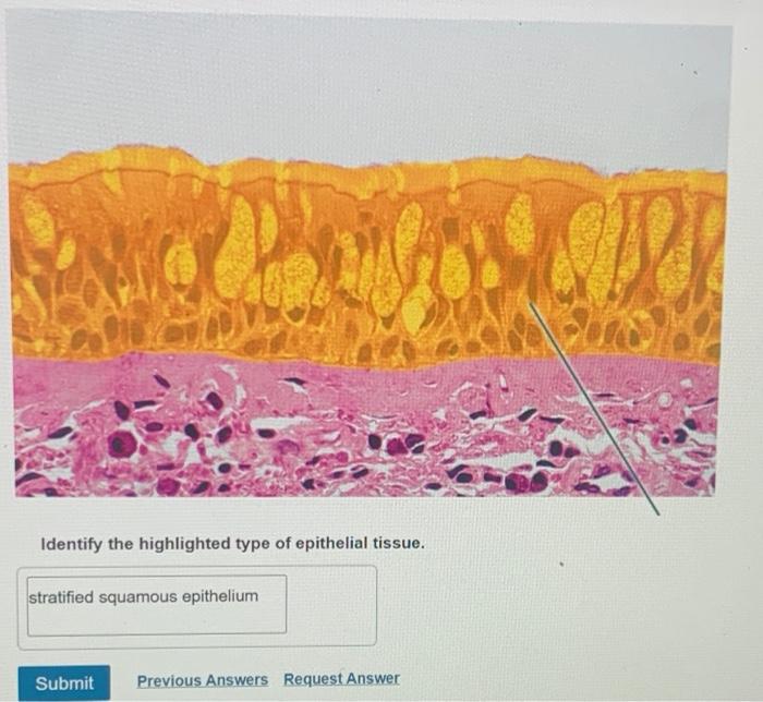 Solved Identify the highlighted type of epithelial tissue.