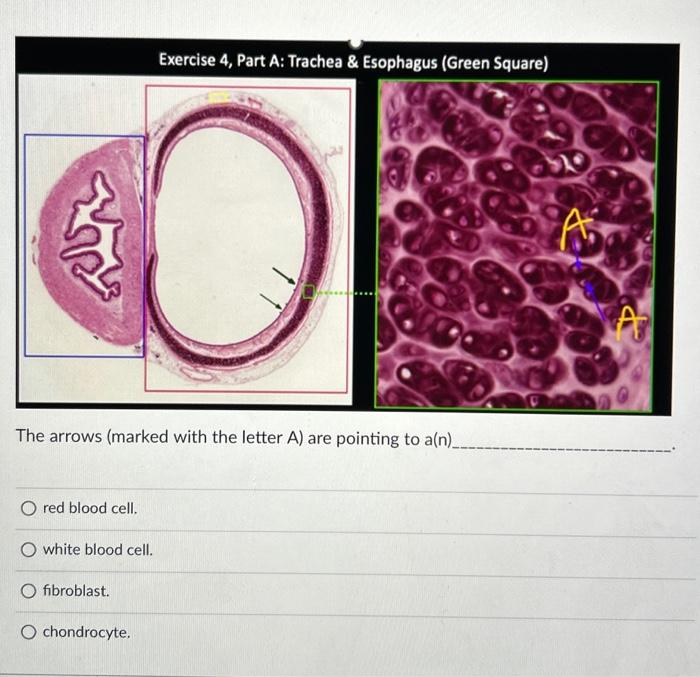 Solved * The arrows (marked with the letter A) are pointing | Chegg.com