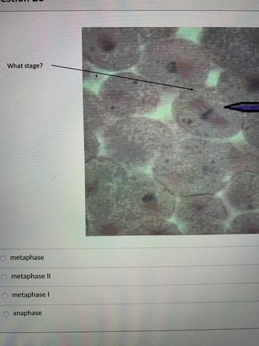 Solved What stage? metaphase metaphase II metaphase 1 | Chegg.com