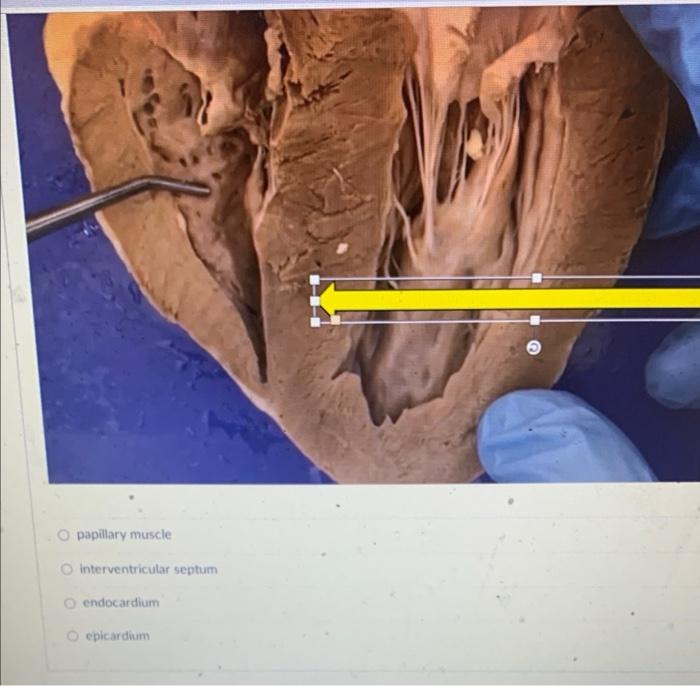 papillary muscle
interventricular septum
endocardium
epicardum