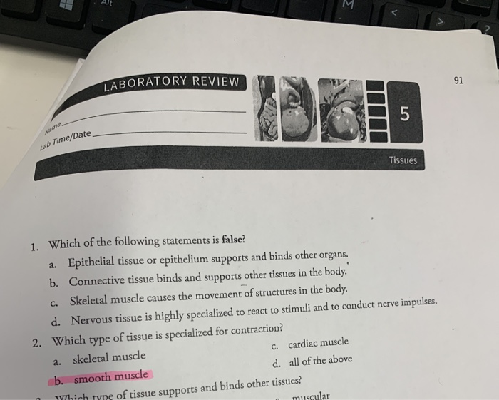 Solved H Aboratory Review Lab Time/Date Tissues 1. Which Of | Chegg.com Solved H Aboratory Review Lab Time/Date Tissues 1. Which Of | Chegg.com