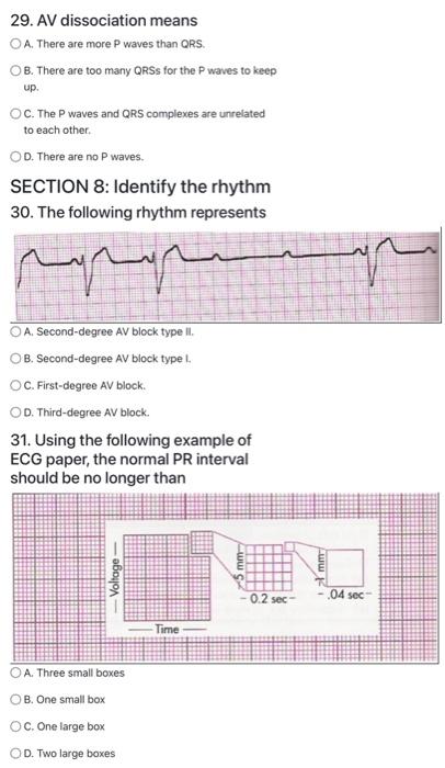 Solved 29. AV dissociation means A. There are more P waves | Chegg.com