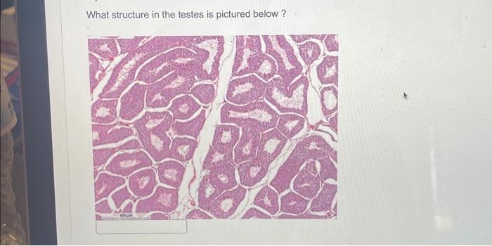 solved-what-structure-in-the-testes-is-pictured-below-chegg