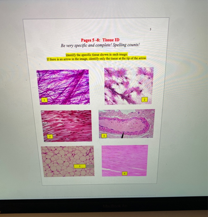 Solved 5 Pages 5-8: Tissue Id Be Very Specific And Complete! 