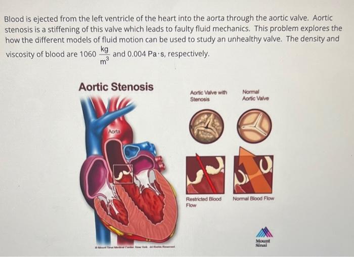 Solved Blood is ejected from the left ventricle of the heart | Chegg.com