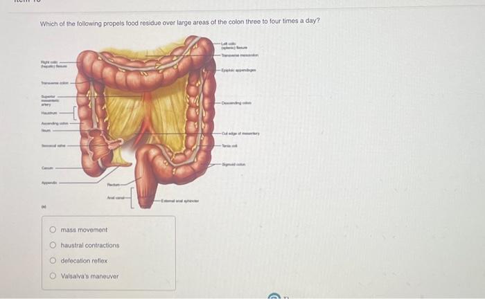 Solved The uvula is an extension of the (b) Anterior view | Chegg.com