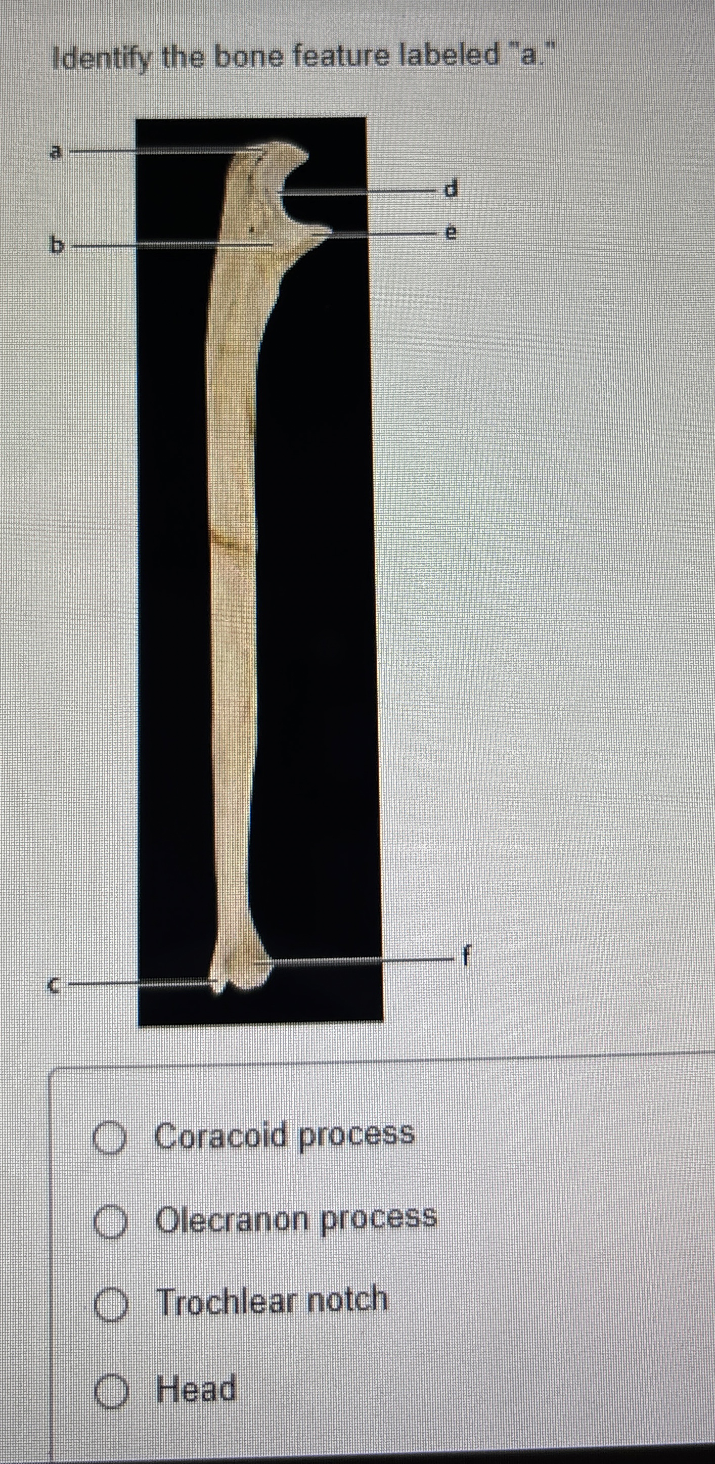 Solved Identify the bone feature labeled 