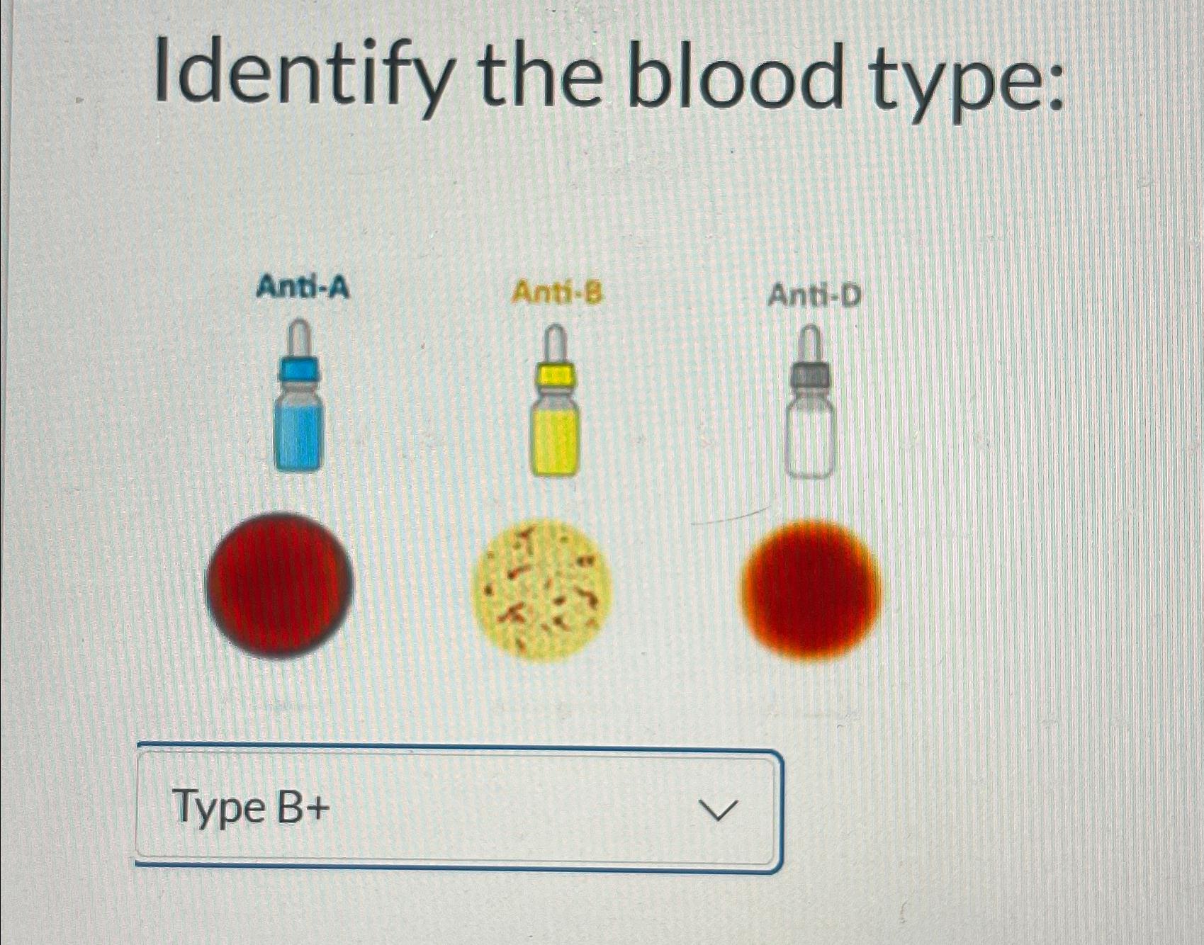 solved-identify-the-blood-type-anti-aant-banti-d-chegg