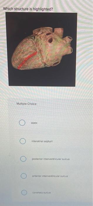 Which structure is highlighted?
Multiple Choice
apex
interatrial septum
posterior interventricular sulcus
anterior interventr