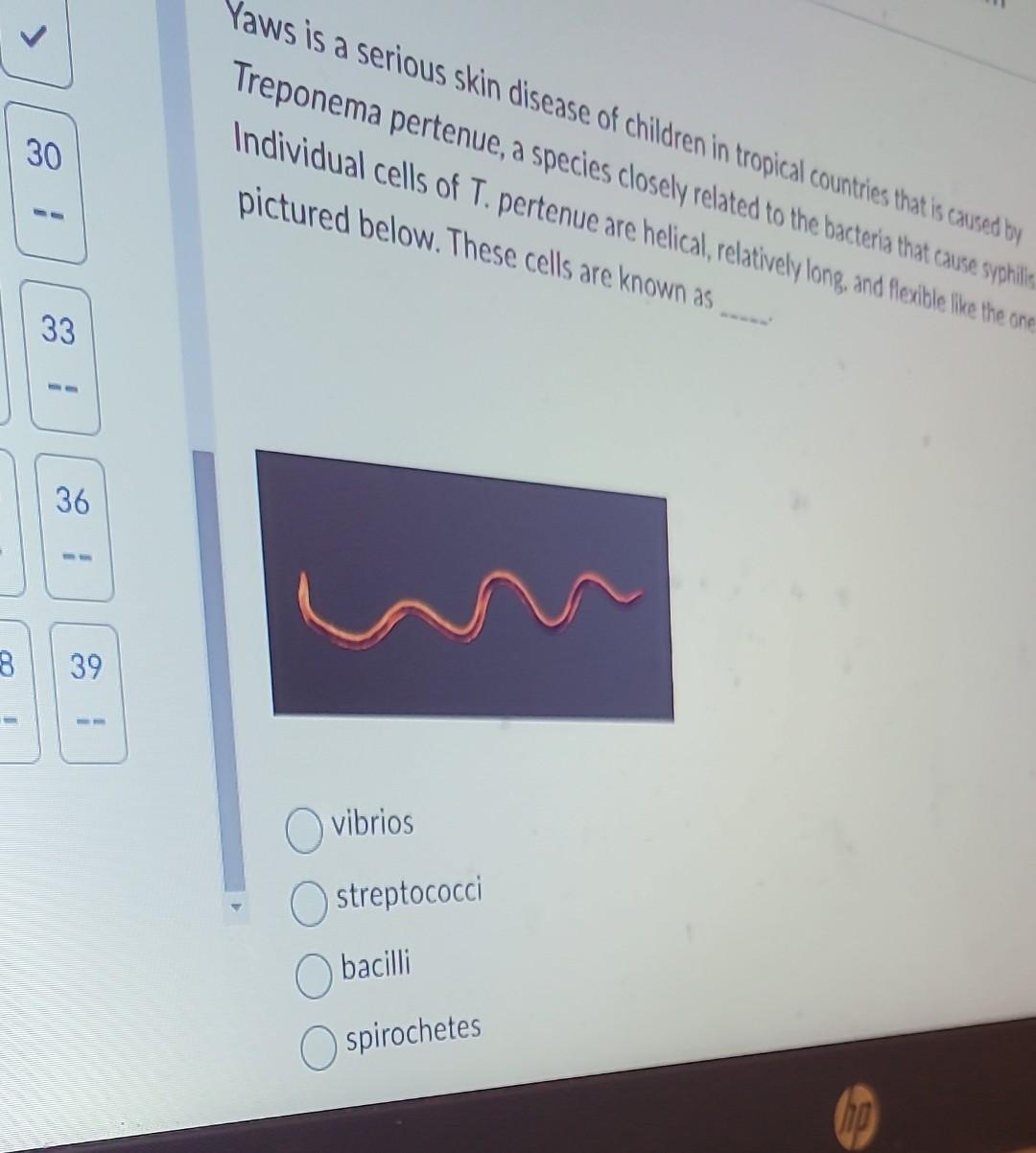 Solved 1) Listen Which statement is TRUE? Prokaryotes lack