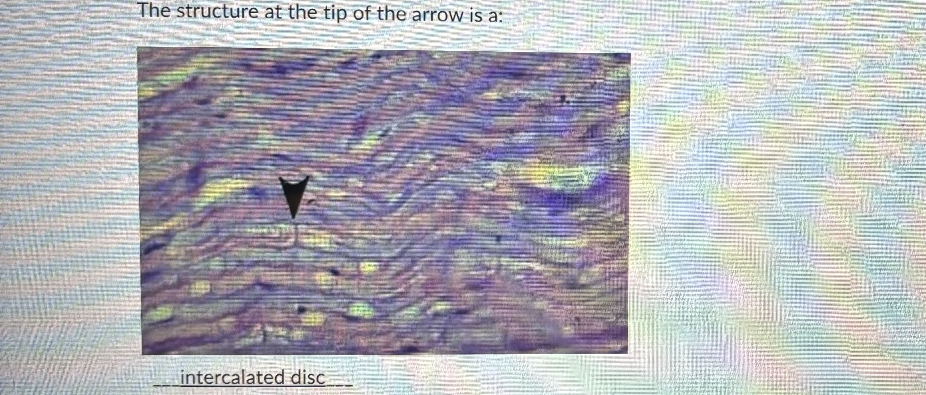 The structure at the tip of the arrow is a