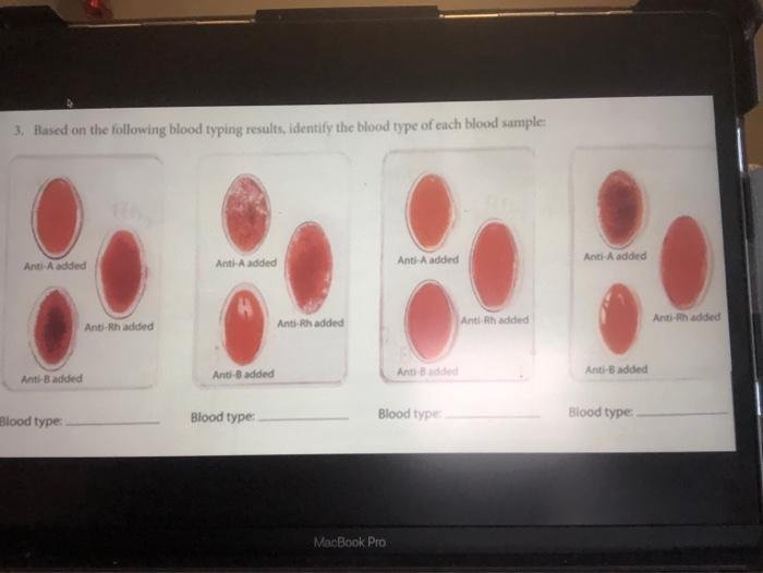 Solved Activity B: Blood Typing In The Lab Materials 1 Blood | Chegg.com