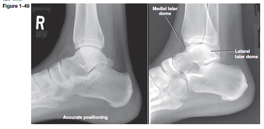 Figure 1-49 demonstrates an accurately and a poorly pos... | Chegg.com