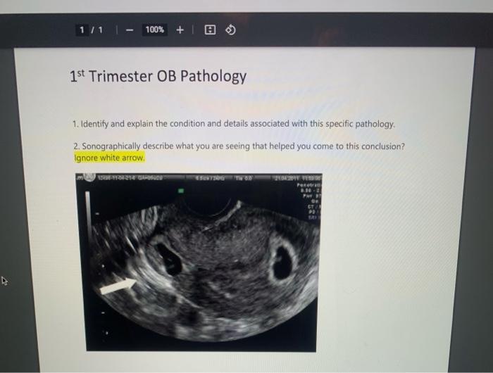 Solved 1111 100% + @ 1st Trimester OB Pathology 1. Identify | Chegg.com