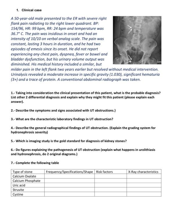 Case 4-2013 — A 50-Year-Old Man with Acute Flank Pain