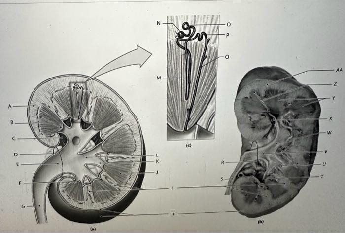 Solved Label the features of the Kidney: v Renal Cortex | Chegg.com