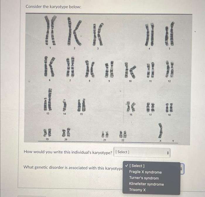 Solved Consider the karyotype below: How would you write | Chegg.com