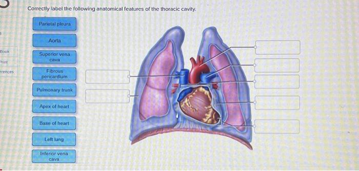 Solved Correctly label the following anatomical features of | Chegg.com