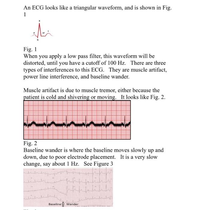 An ECG looks like a triangular waveform, and is shown | Chegg.com